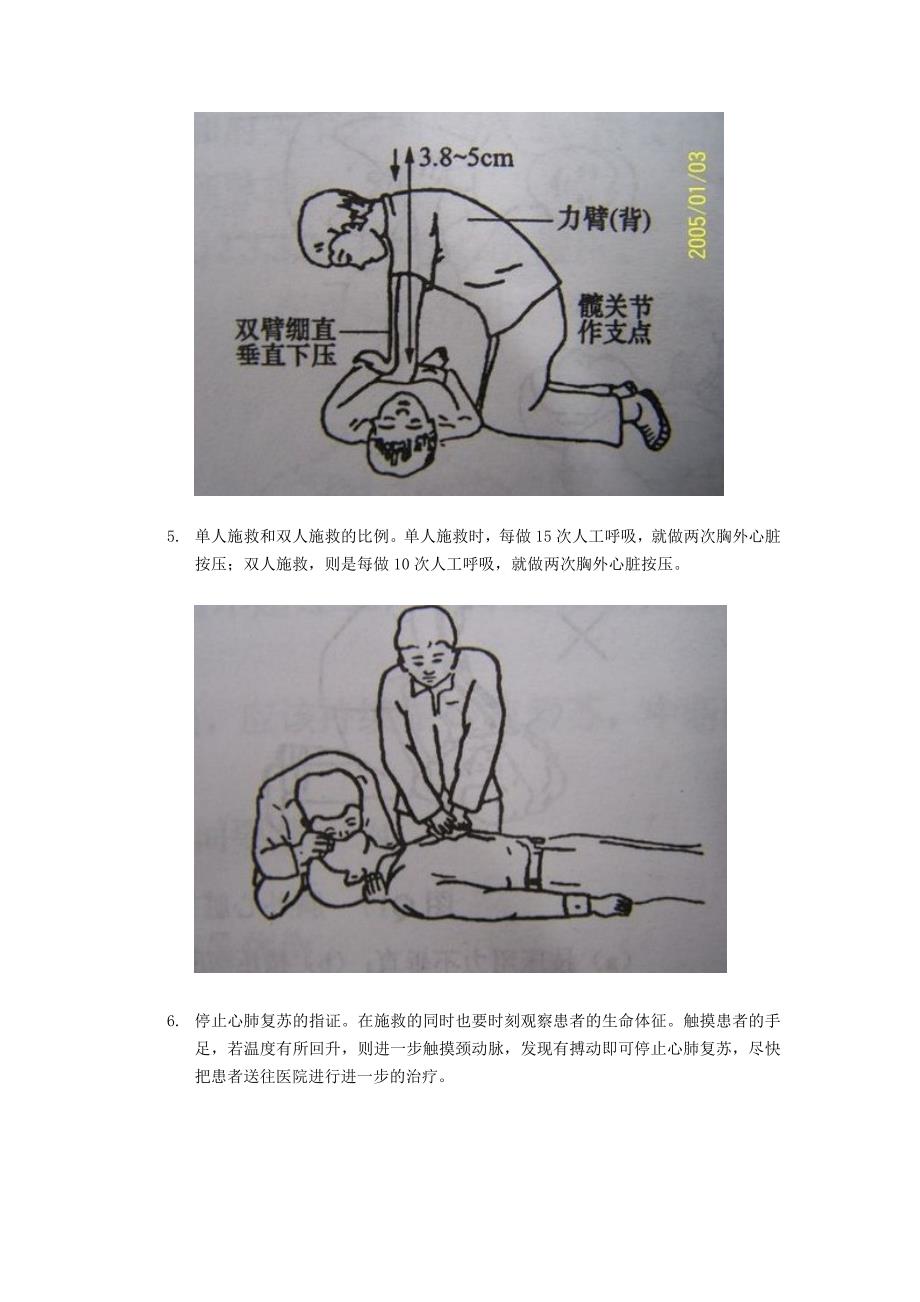 最新版心肺复苏步骤详解解析